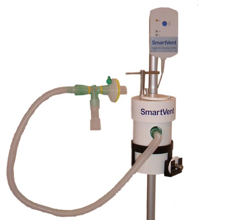 Image du Smartvent- ventilation pulmonaire